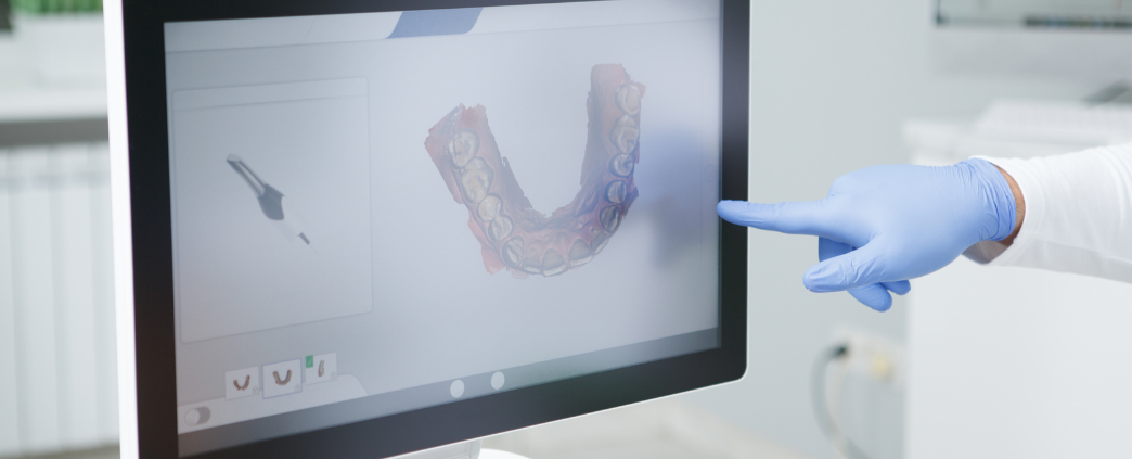Dental laboratories and CAD/CAM design: do you need a partner? - SOi ...