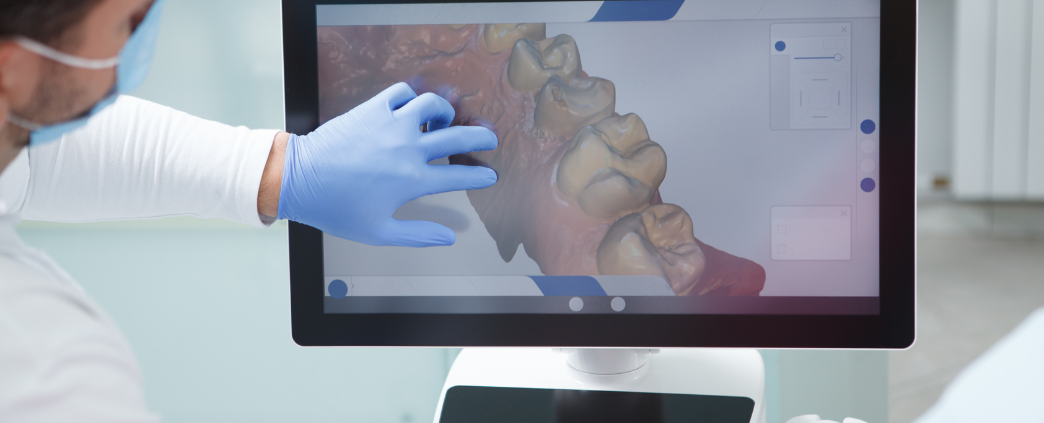 How to determine if a dental CAD design is correctly made: key aspects ...